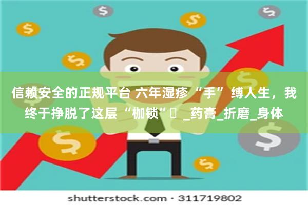 信赖安全的正规平台 六年湿疹 “手” 缚人生，我终于挣脱了这层 “枷锁”​_药膏_折磨_身体